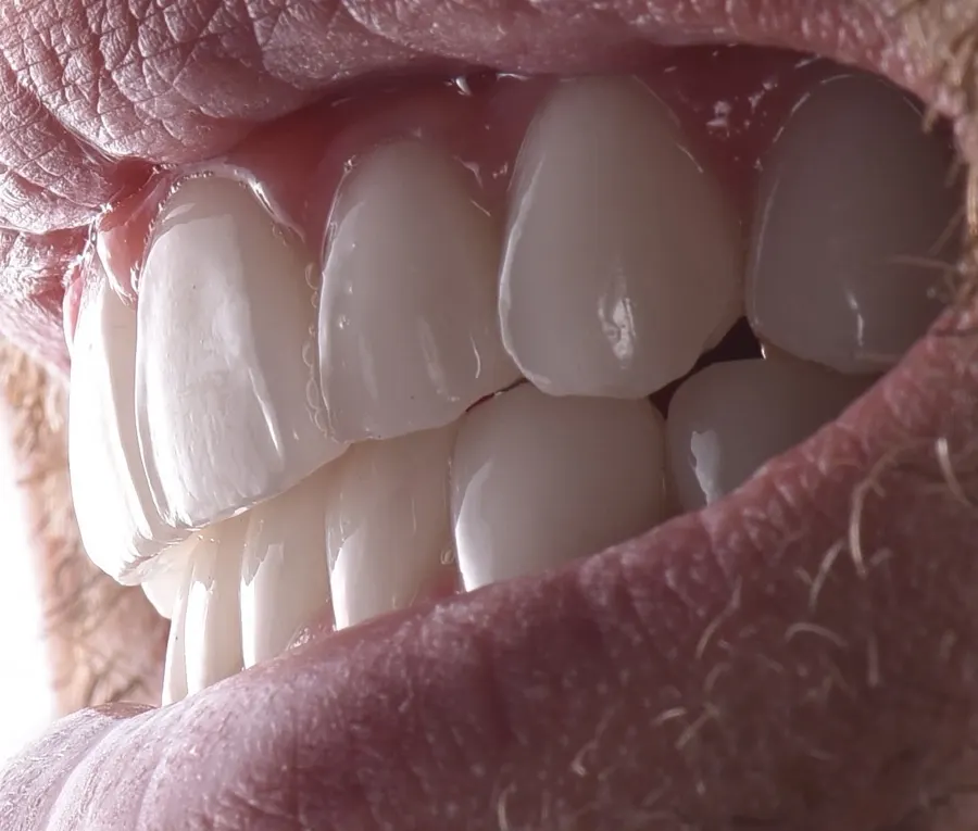 Detalj osmeha